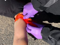 Tourniquet anlage Ein Tourniquet wird an einem Arm angelegt